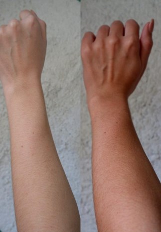 spraytan arm